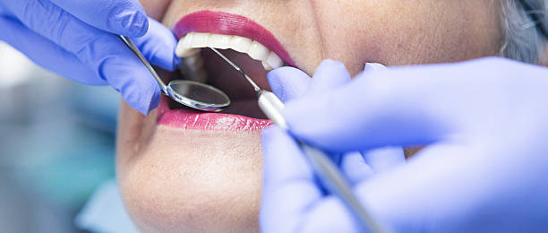 Best Emergency Dentist for Lost Fillings or Crowns in Eggertsville, NY