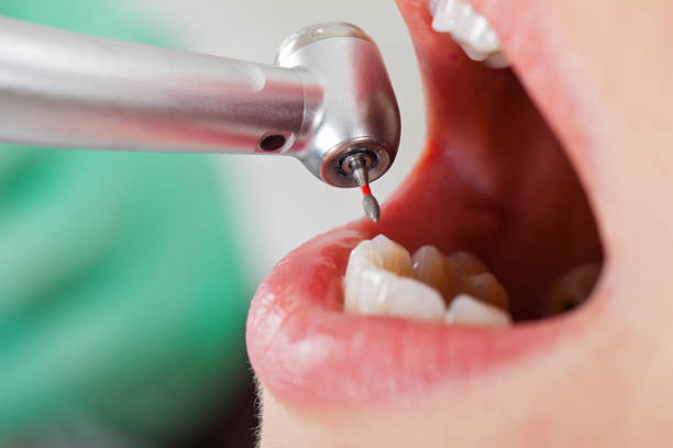 Best Pediatric Emergency Dentist in Eggertsville, NY